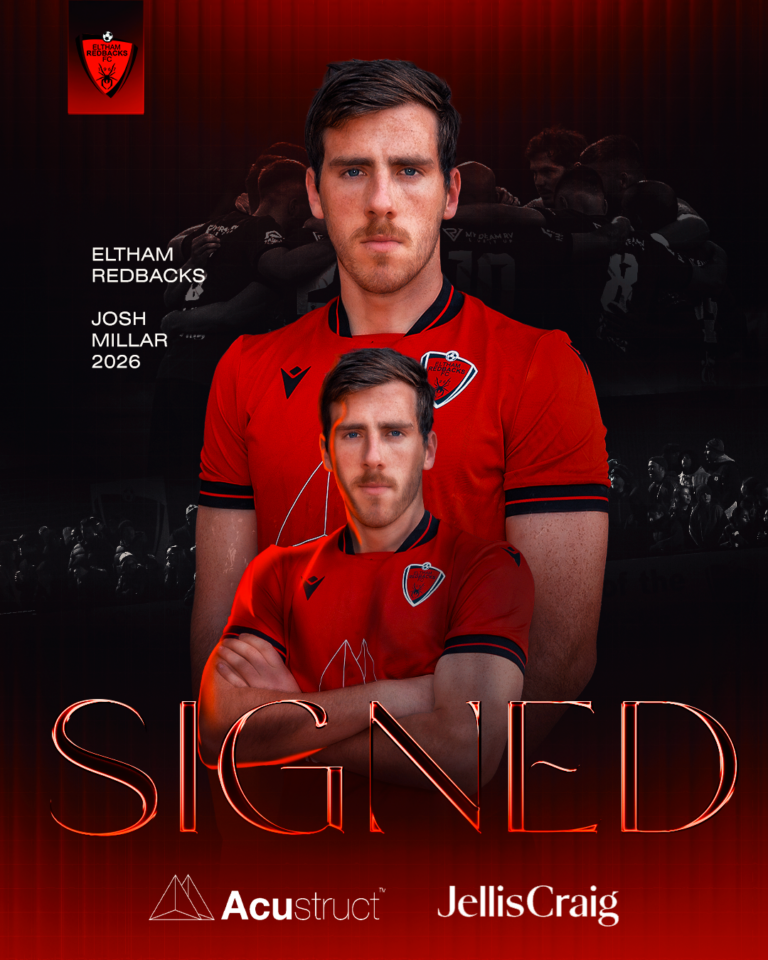 eltham singedjosh (1)